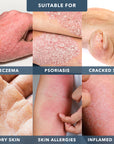 THE REPAIR - E ECZEMA Moisturizer