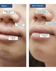 THE REPAIR - E ECZEMA Moisturizer