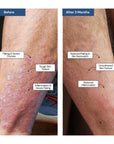 THE REPAIR - E ECZEMA Moisturizer