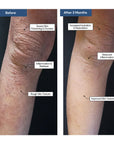 THE REPAIR - E ECZEMA Moisturizer