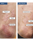 THE REPAIR - E ECZEMA Moisturizer