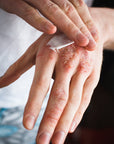 THE REPAIR - E ECZEMA Moisturizer